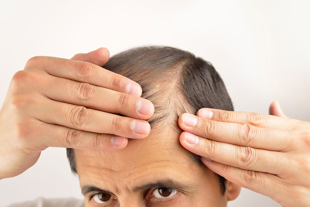 5 Trusted Products That Prevent Hair Loss