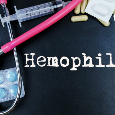 Lifestyle Management Tips for  Hemophilia