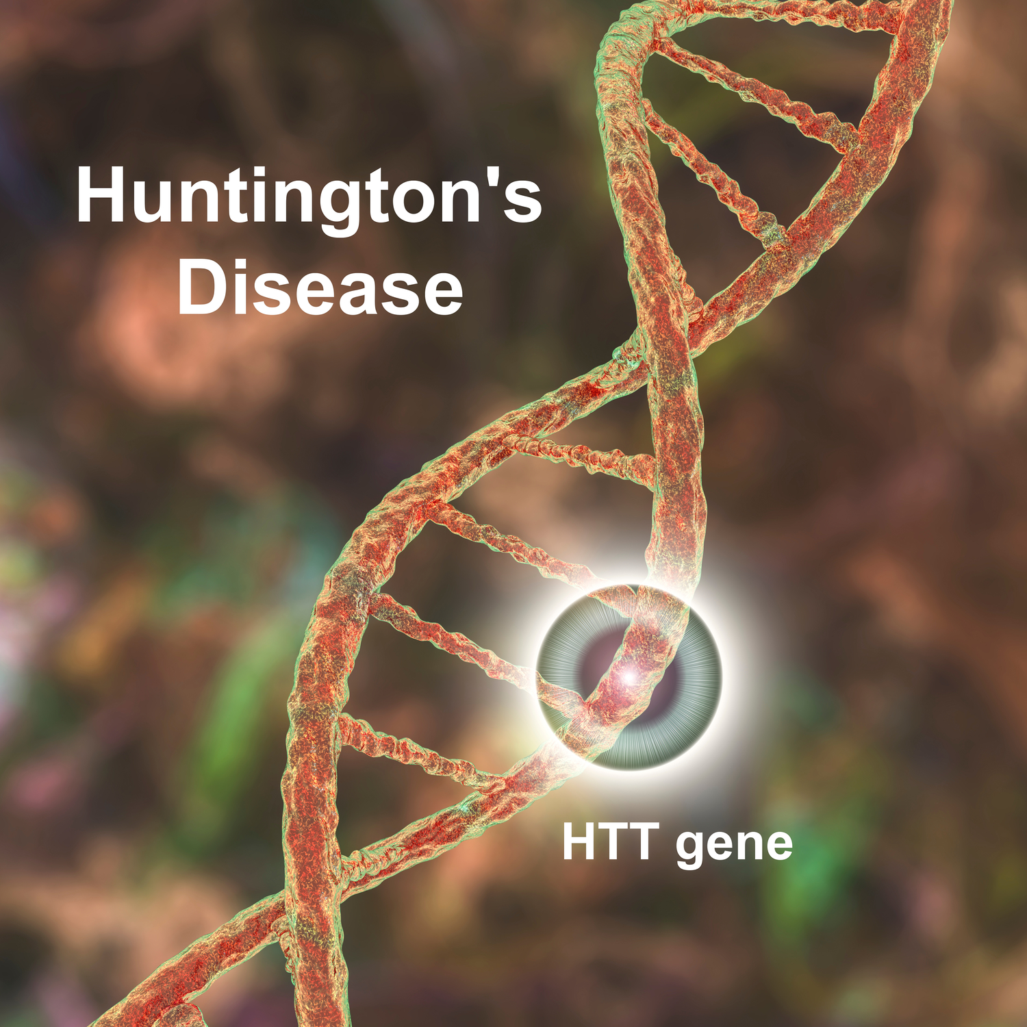 Huntington&#8217;s Disease Early Warning Signs